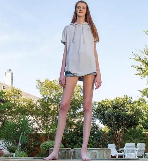世界最长腿记录 腿长达到135厘米