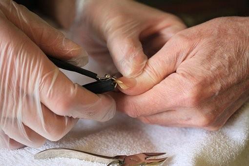 如何正确剪指甲 操作不当有可能得甲沟炎